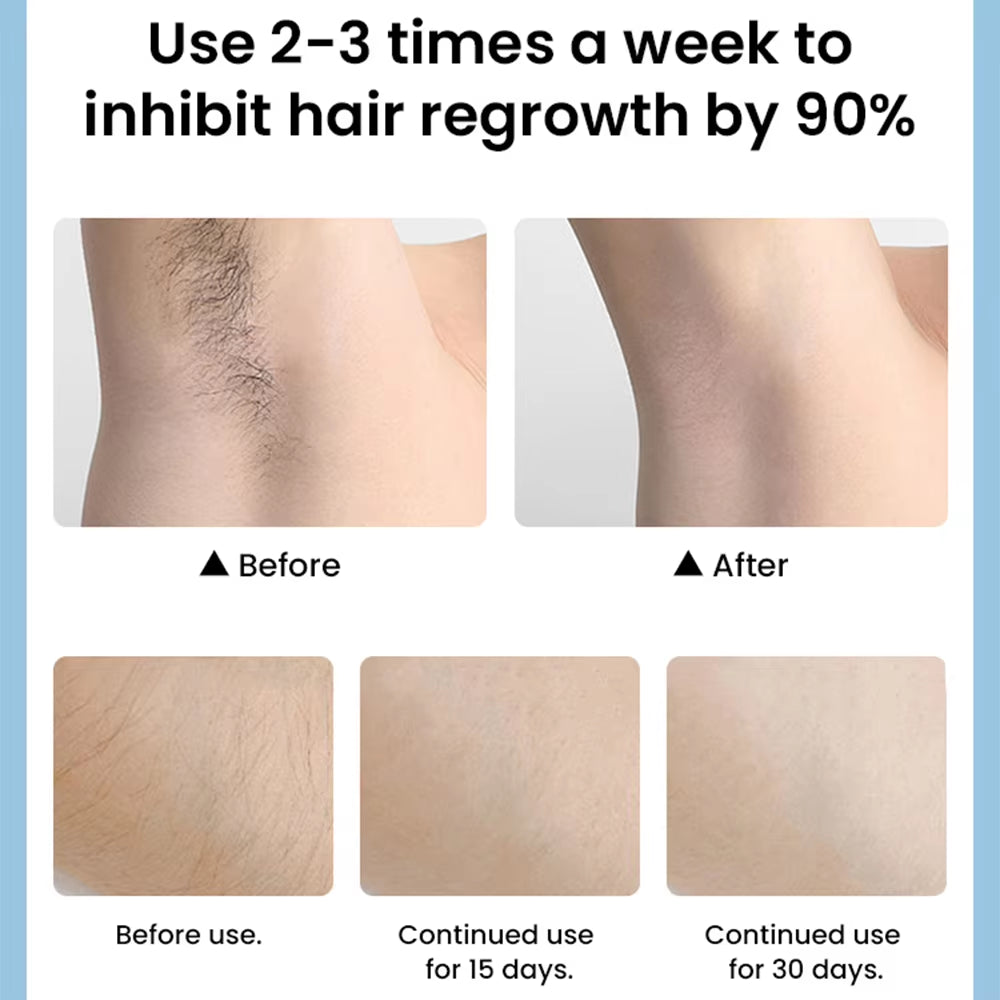 IPL Hair Removal Kit for Women Portable Laser Hair Removal for Bikini Hair Removal Laser Machine Painless Laser Epilator