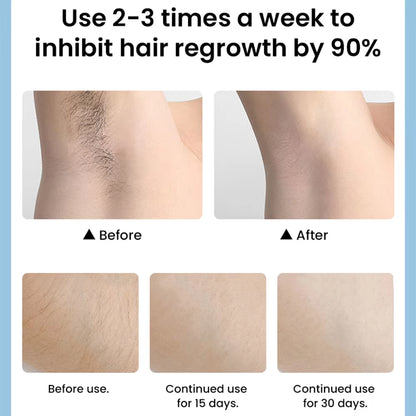 IPL Hair Removal Kit for Women Portable Laser Hair Removal for Bikini Hair Removal Laser Machine Painless Laser Epilator